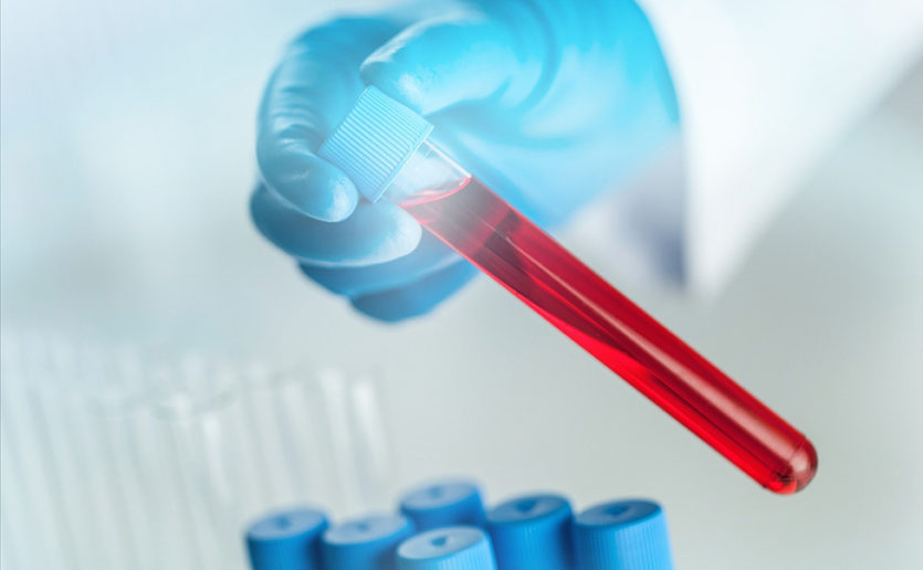 Global Cancer Liquid Biopsy Products Market $5.9 Billion by 2027