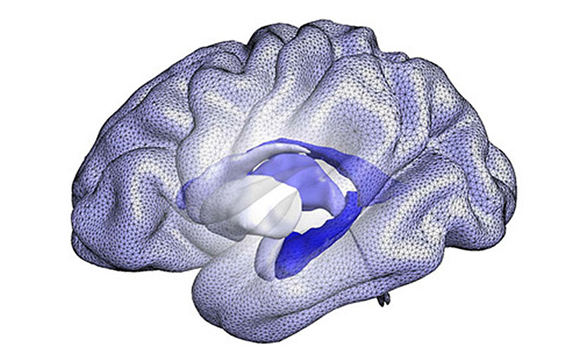 A Brain System That Appears To >> Alzheimer S Disease New Brain Scans Used To Detect Risk A Brain System That Appears To >> Alzheimer S Disease New Brain Scans Used To Detect Risk