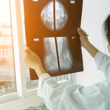 breast cancer artificial intelligence