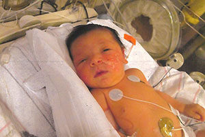 Roman Carvalho was whisked away to the NICU the night he was born.