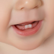 New research suggests that baby teeth may record instances of early life adversity, a known risk factor for future psychiatric disorders.