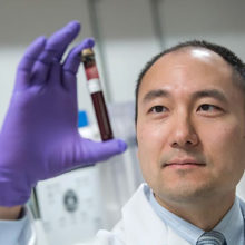David Miyamoto, MD, PhD, a researcher in the field of early cancer detection, examines a blood sample.