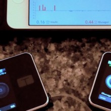 The bionic pancreas is a three-part device including an iPhone with an algorithm that computes insulin and glucagon doses, plus an insulin pump and a glucagon pump. The final version will incorporate all three parts into one device.