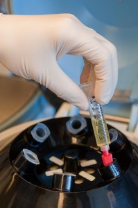 The centrifuge spins tubes of harvested fat to remove excess fluid and blood.